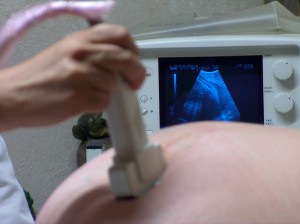 Ultraschall bei Schwangerer